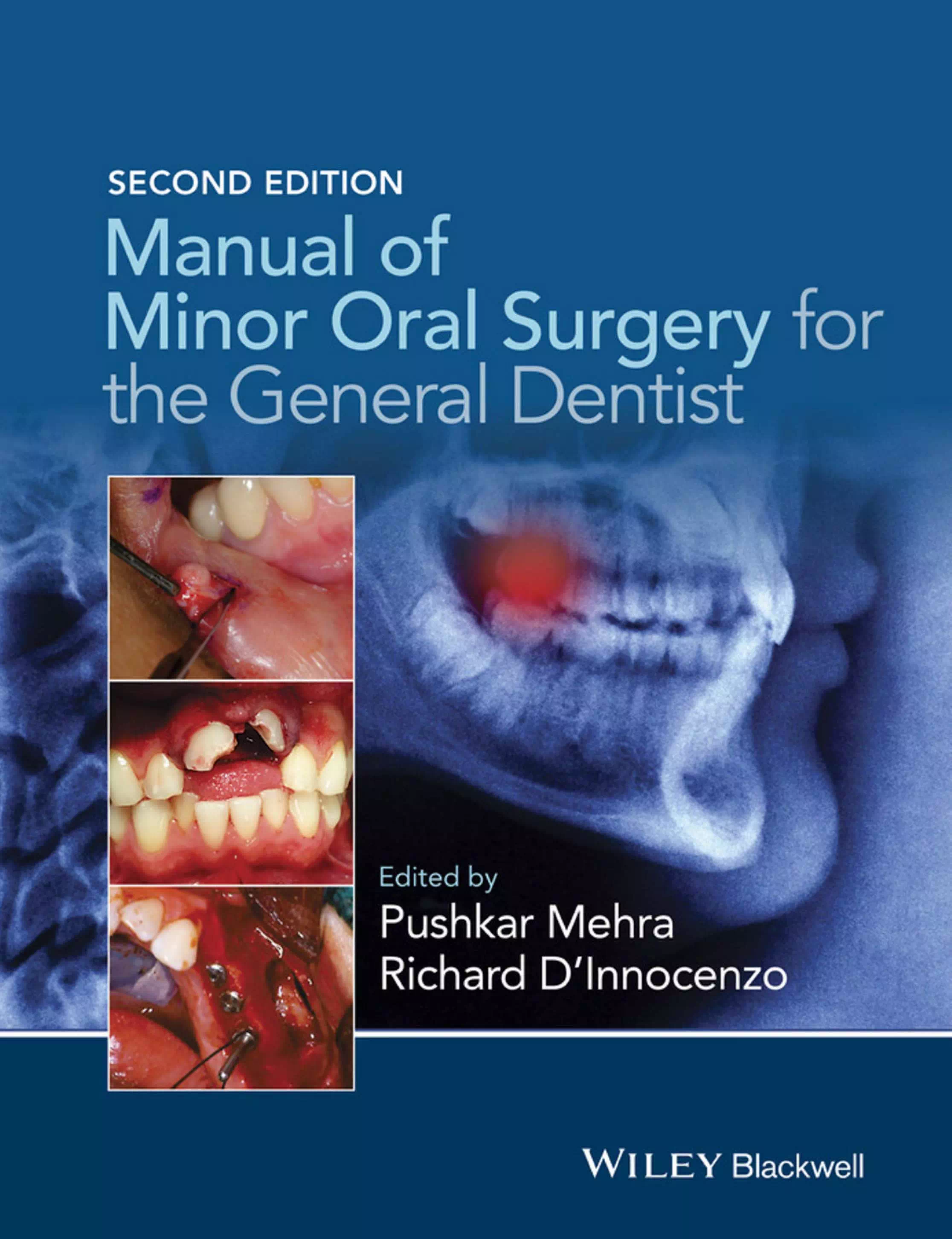 Manual of Minor Oral Surgery for The General Dentist - Pushkar Mehra